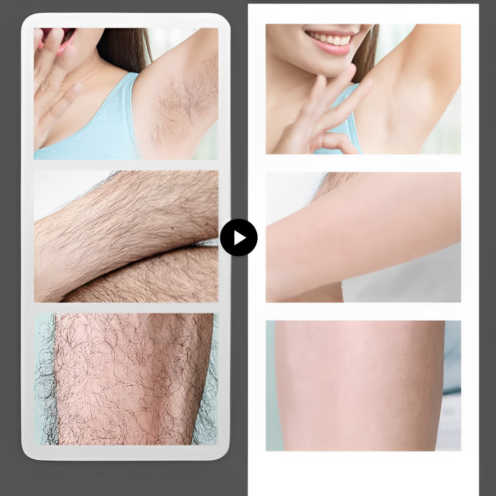 SilkEase 🌸 Makellose Haut leicht gemacht – Sanfte Enthaarungscreme 👙 Ihre Beauty-Geheimwaffe für die Bikinisaison!