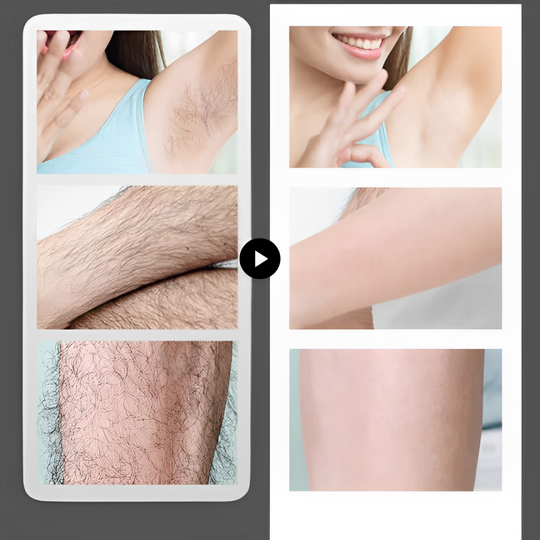 SilkEase 🌸 Makellose Haut leicht gemacht – Sanfte Enthaarungscreme 👙 Ihre Beauty-Geheimwaffe für die Bikinisaison!