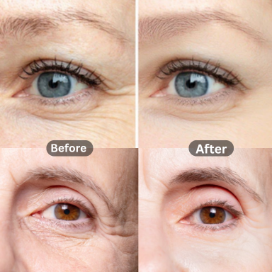 Peter Thomas Roth, Clinical skin care