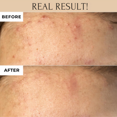 Ground Glow Mask Pore Koreanische Hautpflege