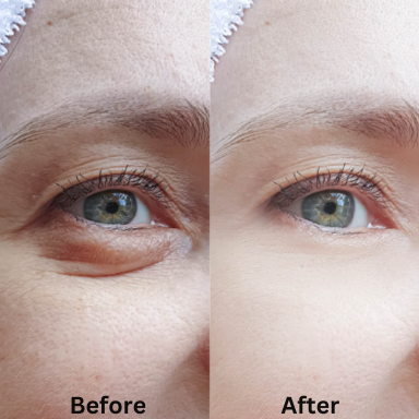 Peter Thomas Roth, Clinical skin care