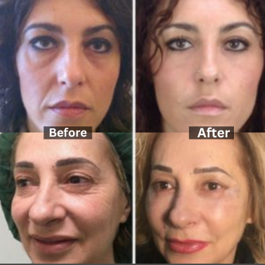 Peter Thomas Roth, Clinical skin care